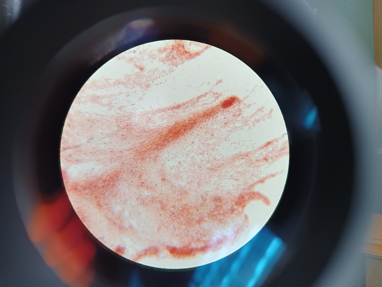 Dental Grade 2 bacteria