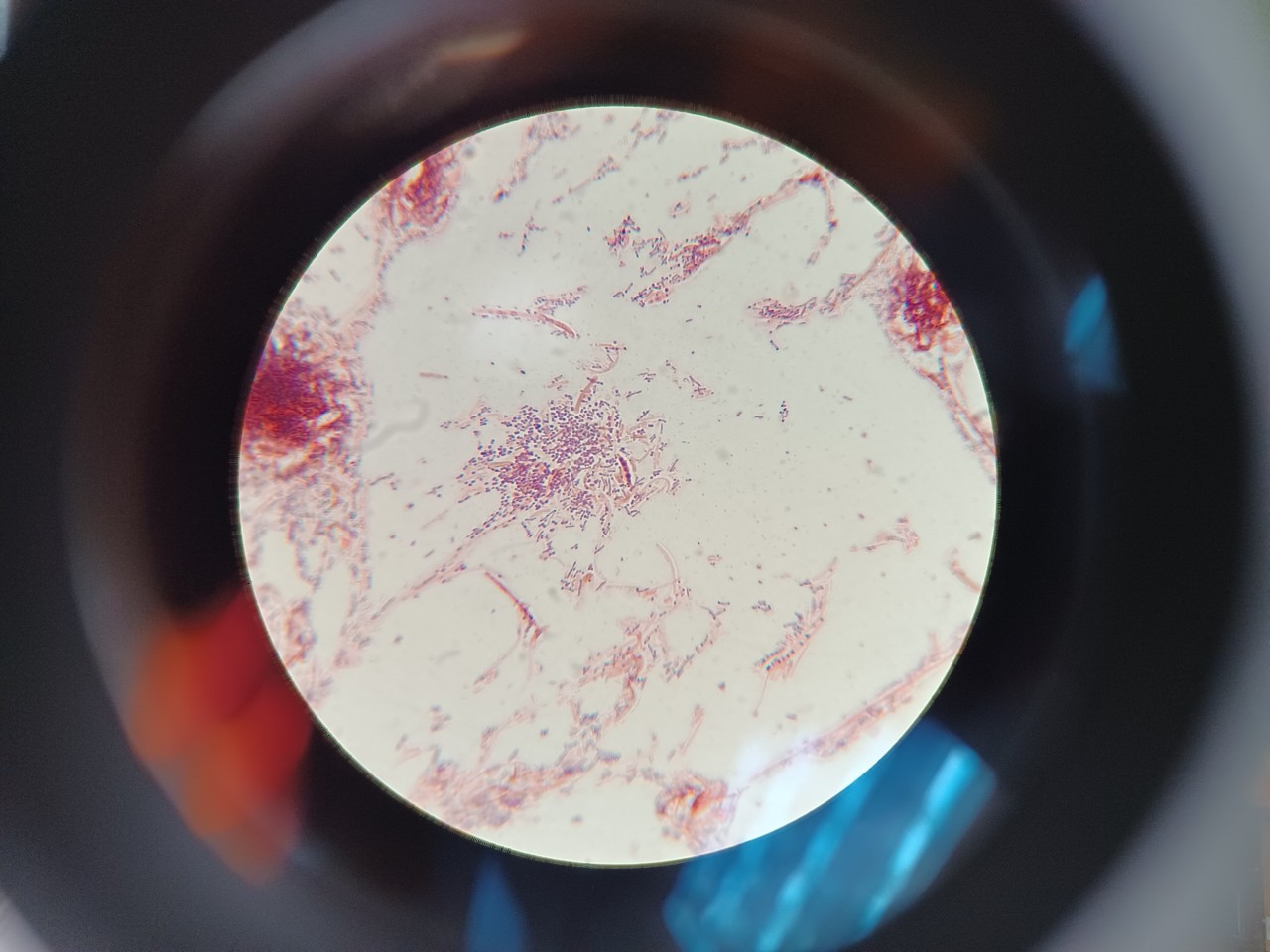 Dental grade 3 bacteria